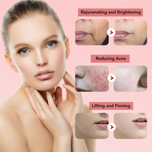 EMS Facial Massager LED Light Anti Aging Wrinkle Facial Care